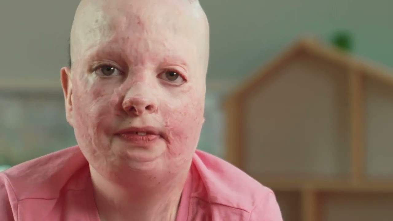 Patient Elizabeth Explains Why She Supports Birmingham Children's Hospital Charity