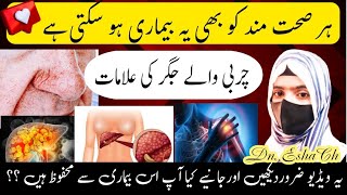 Fatty liver disease || Fatty liver Symptoms || Fatty liver