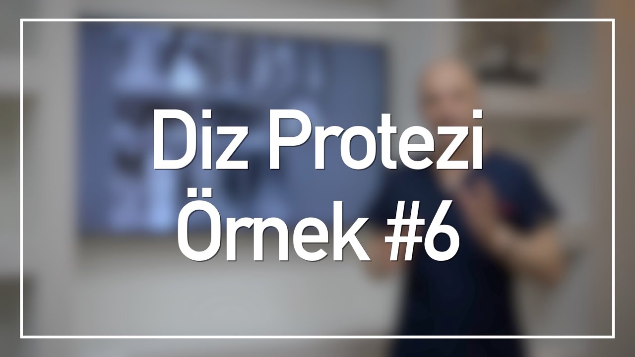 Diz Protezi Vaka Örnekleri #6