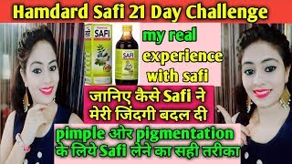 Safi Removes Pimples ? Hindi Safi Full Honest Review My Experience With Safi