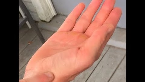 1st CMC Joint Arthrokinematics