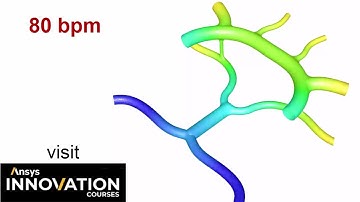 3D Blood flow simulation in Circle of Willis | Ansys Innovation | CFD in Healthcare | Carreau Model