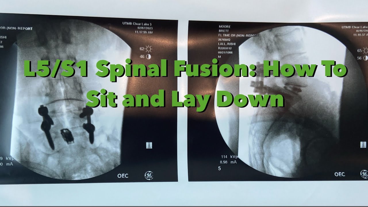 L5/S1 Spinal Fusion How to Lay Down and Get Back Up YouTube