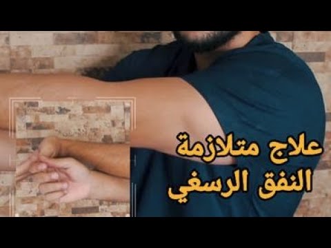 3 تمارين لعلاج متلازمة النفق الرسغيعلاج الم مفصل اليد (الرسغ) | Carpal tunnel  syndrome