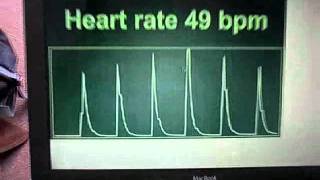 Heart meter with Javascript, HTML5, Push over WebSockets and embedded Ubuntu Linux