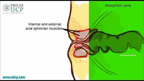 Learn How To Insert Anal Suppository - SMILES Gastroenterology