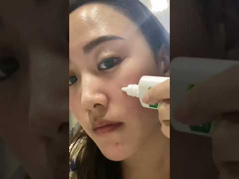 Video: Mentholatum Acnes Powder Lotion Review