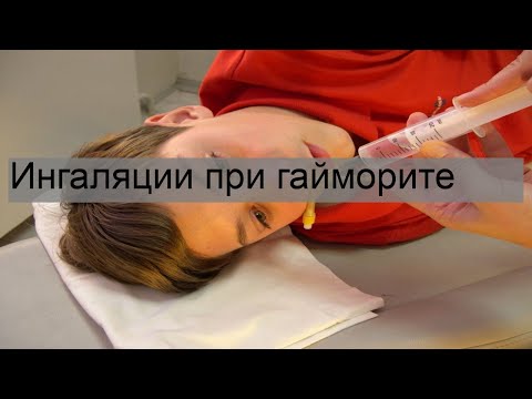 Ингаляции при гайморите