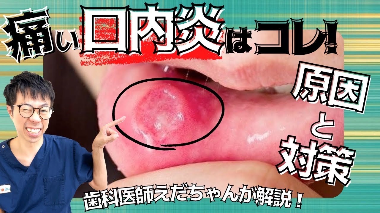 細菌感染による喉の痛みはどのくらい続きますか?