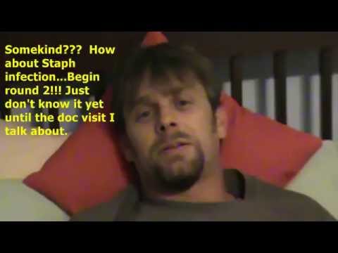 Journal Sinusitis Journal Sinusitis