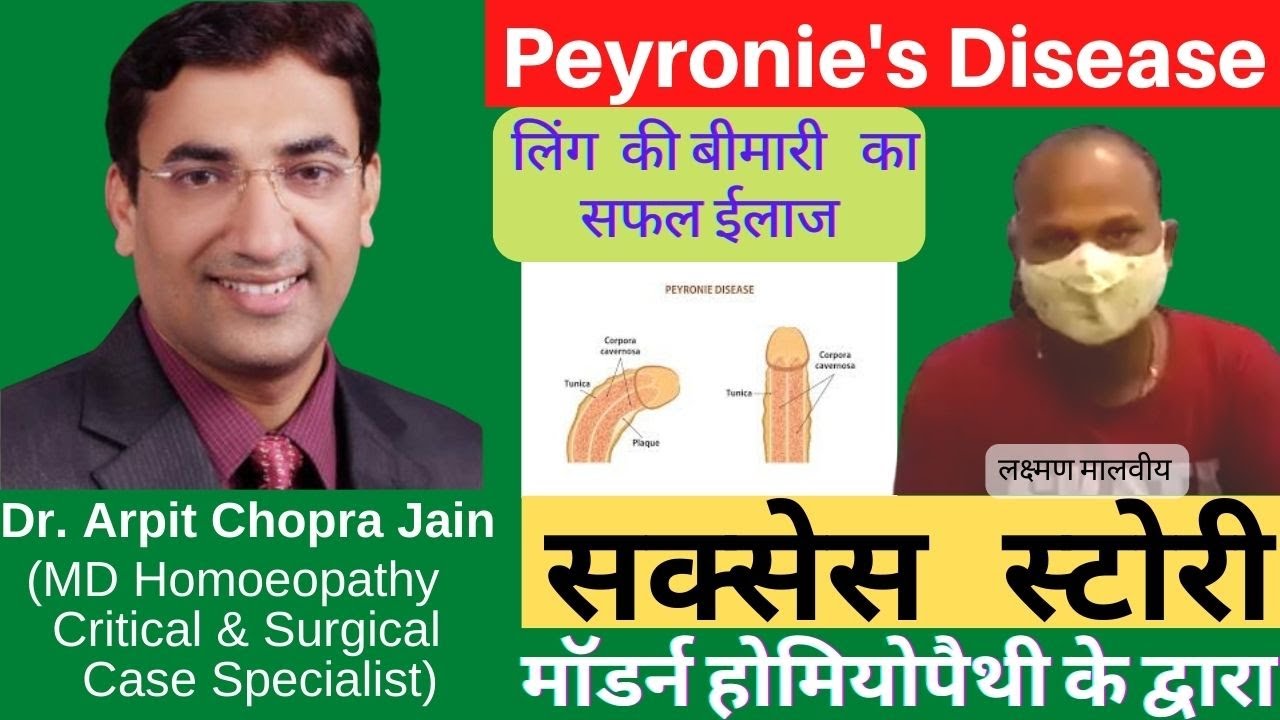 Peyronie's Disease Success Stories|Peyronie's Disease Cured |Dr. Arpit