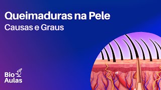 Tipos de Queimaduras: Primeiro, Segundo e Terceiro Grau