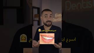 ‎ ازاي تعملي ابتسامة المشاهير قبل الفرح بأقل تكلفه واسرع وقت ?‍♀️ ?