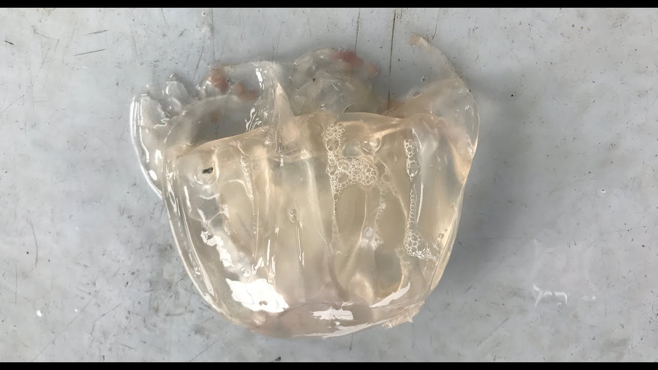 Deadly box jellyfish invasion in Penang