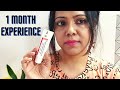 My 1 Month Experience with Demelan Cream | Honest Review