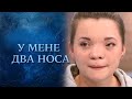 У меня два носа (полный выпуск) | Говорить Україна