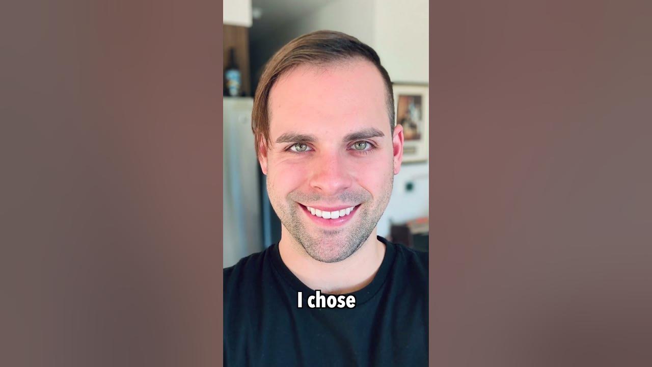 I've Tried EVERY BALDING "Solution"