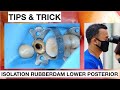 Tips and Trick Isolation With Rubberdam Lower Premolar With Double Clamp | General Dentist Griya RR