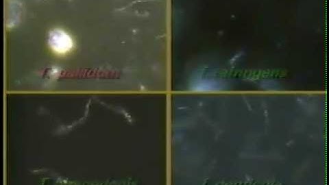 Treponema/ Syphilis Darkfield Video (CDC)