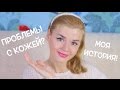 Проблемы с кожей? Как избавиться от прыщей? Моя история!