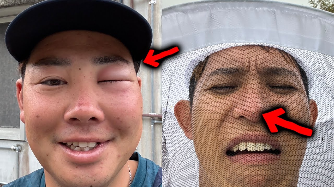 蜂に刺されて大変なことになりました【養蜂#7】