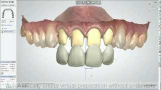 Dental System™  2013 - TRIOS Color Digital Temporary