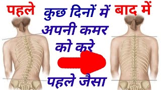 back pain treatment || scoliosis exercises in hindi