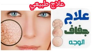 العلاج الطبيعي الأقوى والأساسي لجفاف الجلد / خلطة طبيعية مع نصائح مهمة??