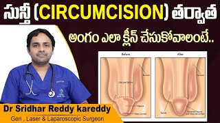 సున్తీ తర్వాత అంగం క్లీన్ | Post-Circumcision Care | Circumcision Care | Treatment Range Hospitals