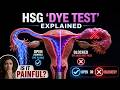 Does the HSG Fertility Test Actually Hurt? The Honest 3D Truth 🩺