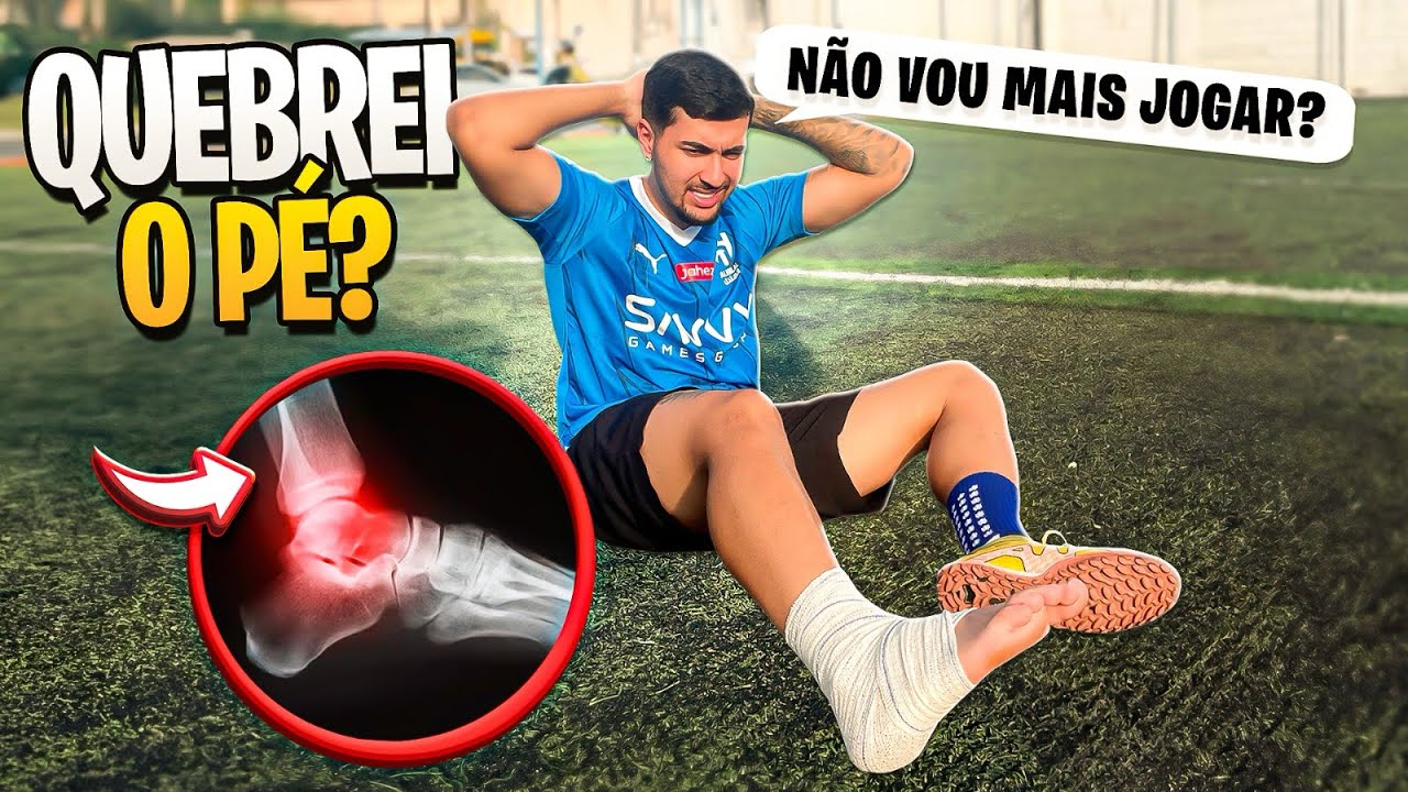 ME MACHUQUEI FEIO DURANTE ESSE VIDEO!!😱*Não vou poder jogar mais futebol?*