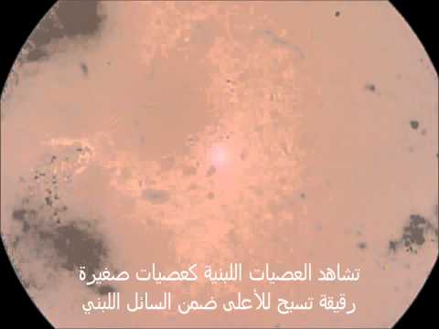 فوائد اللبن الزبادي السوري الشامي