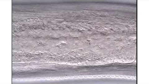 Metacrobeles female nematode 7