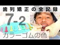 カラーモジュール（ゴム）色選び＆装置・ワイヤーに取り付け：歯列矯正の記録058