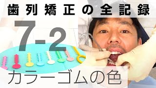 カラーモジュール（ゴム）色選び＆装置・ワイヤーに取り付け：歯列矯正の記録058
