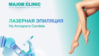 Лазерная эпиляция волос на аппарате Candela