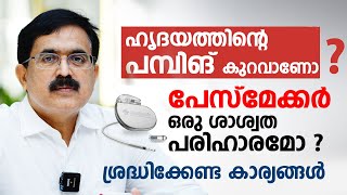 ഹൃദയത്തിന്റെ പമ്പിങ് കുറവാണോ ? All about pacemaker | Dr. Yusuf Kumble | Arogyam