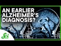 Catching Alzheimer's 25 Years Earlier