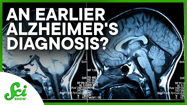 Catching Alzheimer's 25 Years Earlier