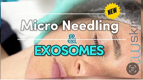 Transform Your Skin: Microneedling + Exosome Treatment.