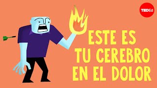 ¿Cómo responde tu cerebro al dolor? - Karen D. Davis