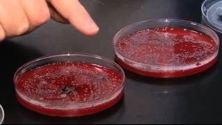 SPECIAL REPORT: How dirty are your hands?