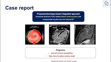 Chẩn đoán bệnh cơ tim theo khuyến cáo ESC 2023: như thế nào là đủ?
