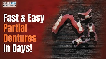 Fast & Easy Partial Dentures in Days! 😁👍