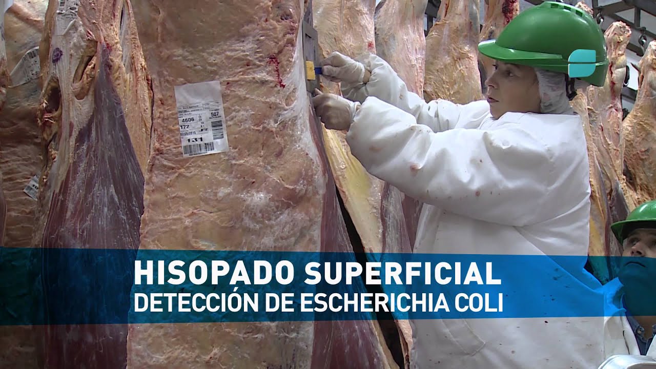 Prevención del Síndrome Urémico Hemolítico - YouTube