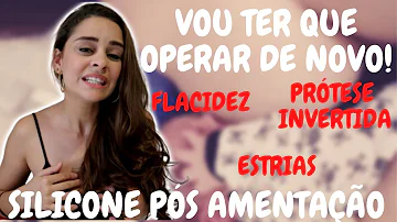Como fica o silicone depois da gravidez?