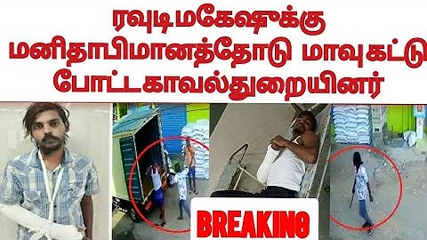 ரவுடி மகேஷுக்கு மனிதாபிமானத்தோடு மாவு கட்டு போட்ட காவல்துறையினர்.....