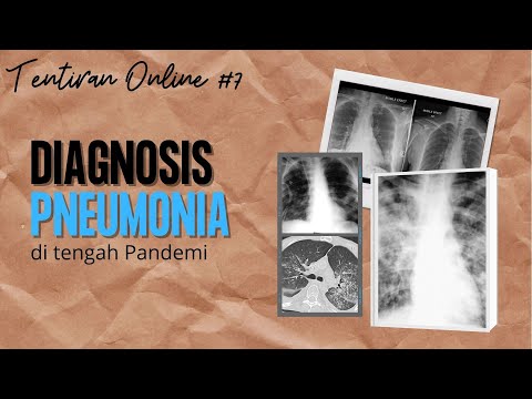 Video: Nilai Diagnostik Lavage Bronchoalveolar Pada Penyakit Paru Interstitial