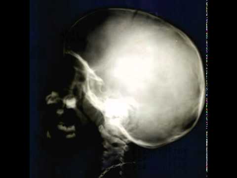 Punk music video thumbnail preview for Anti-Venöm - 555... Wait, Wha!?