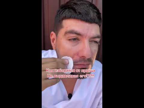 Как быстро избавиться от прыща? - YouTube